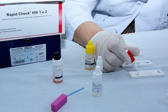 Teste rápido de HIV e DSTs: procura pelo exame reduziu nas unidades básicas de saúde